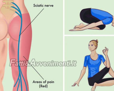 Corpo & Mente. La sciatalgia: ecco esercizi e posizioni yoga  per  prevenire o debellare il dolore