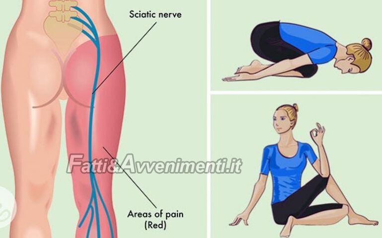 Corpo & Mente. La sciatalgia: ecco esercizi e posizioni yoga  per  prevenire o debellare il dolore
