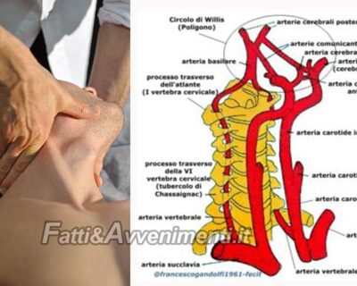 Salute & Benessere. Manipolazioni vertebrali sicure solo in mani esperte: l’insufficienza vertebro-basilare