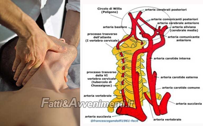 Salute & Benessere. Manipolazioni vertebrali sicure solo in mani esperte: l’insufficienza vertebro-basilare