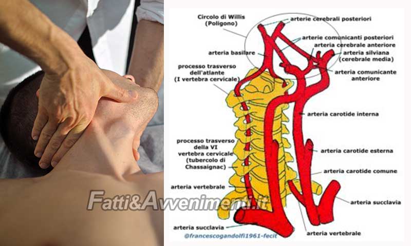 arteria vertebrale)