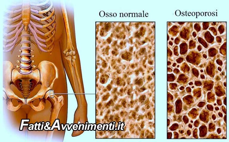 Salute &Benessere. Osteoporosi: le cause e il ruolo non secondario dell’ambiente